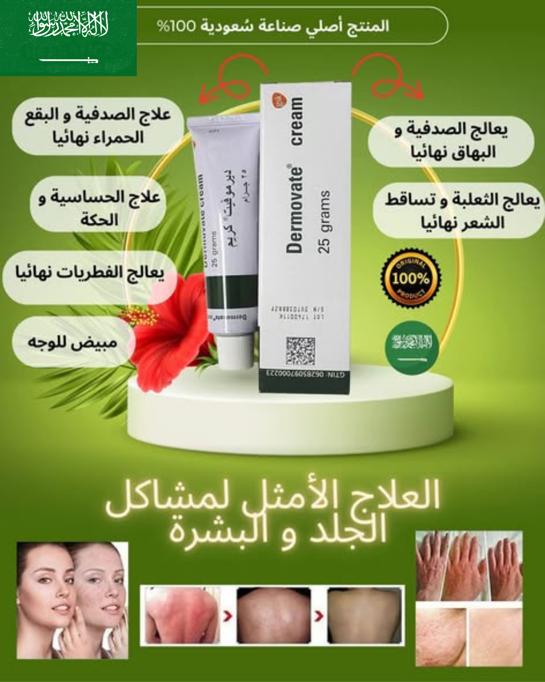 ديرموفيت (Dermovate)