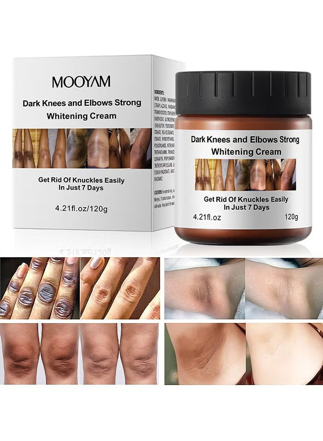 كريم تبييض و تفتيح البشرة الداكنة من mooyam